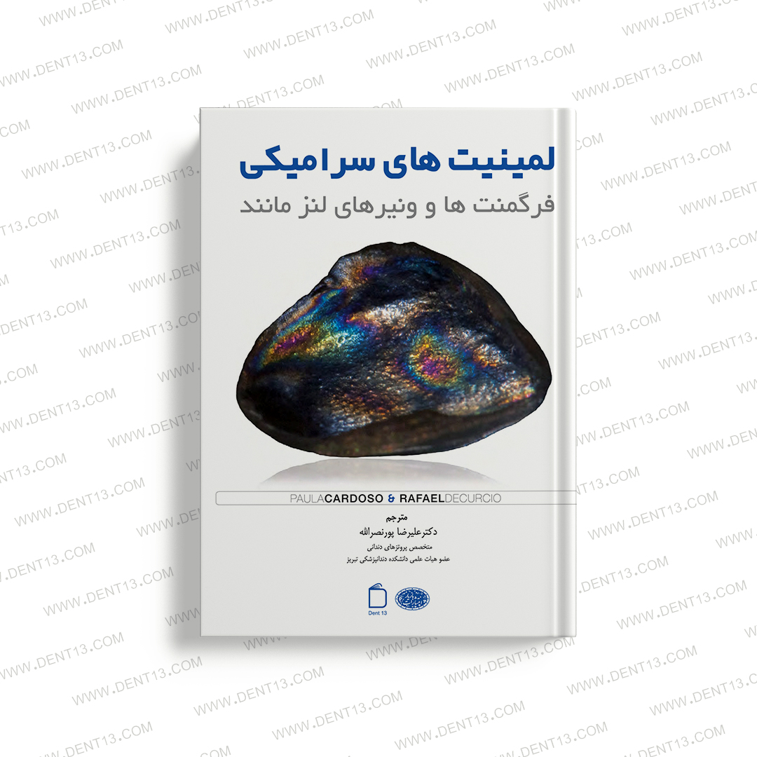 لمینیت های سرامیکی - فرگمنت ها و ونیرهای لنز مانند