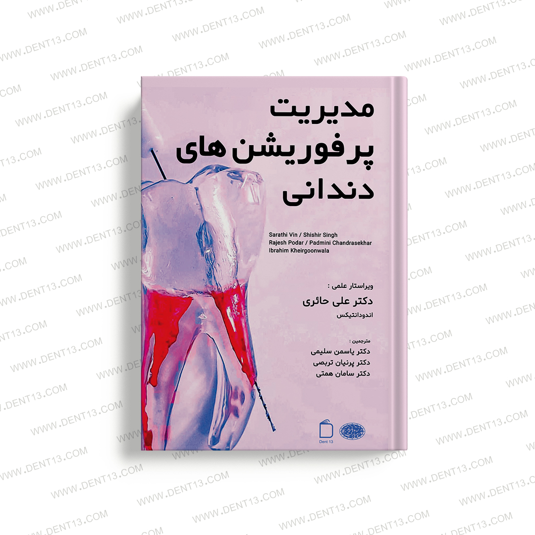 مدیریت پرفوریشن های دندانی